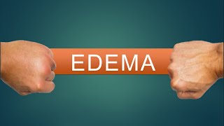 FISIOPATOLOGIA DEL EDEMA [upl. by Dorraj]