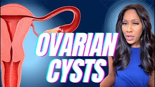 What Are Ovarian Cysts What Are the Symptoms How Are Ovarian Cysts Treated A Doctor Explains [upl. by Faust]