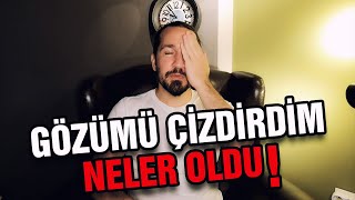 Göz Çizdirmeyi Düşünüyorsanız İzleyin İ  LASİK [upl. by Nwahsyar]