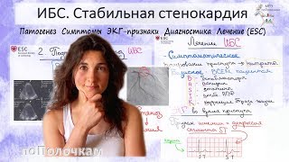 Самое важное по теме ИБС и стабильная стенокардия [upl. by Scherman]