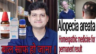 Homeopathic medicine for Alopecia areata  explain everything  permanent result [upl. by Pruter]