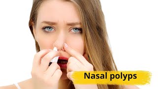 Nasal polyps Causes symptoms and treatments [upl. by Irahs616]