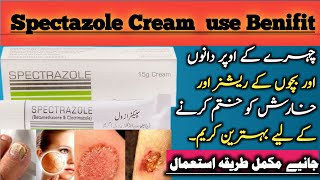 Spectazole cream uses in urdu  Clotrimazole and betamethasone [upl. by Nayrda]