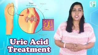 Uric Acid Symptoms Causes And Treatment  How To Reduce Uric Acid  Home Remedies In English [upl. by Witha]