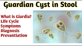 what is giardia cyst I what is giardia cyst under microscope [upl. by Sivrahc]