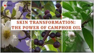 Skin Transformation The Power of Camphor Oil Discover the Wonders of Camphor Oil for Skin [upl. by Brahear26]