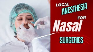 A Better Way to Apply Nose Local Anesthesia nasal anesthesia [upl. by Idelia]