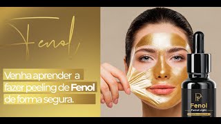 Peeling de Fenol Resultado Final 5 [upl. by Nuhsal802]