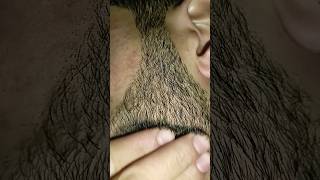 hair dresser viralshort hairremoval hairproblem [upl. by Eetsirk]