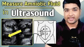 How to measure amniotic fluid index by ultrasound  Amniotic fluid level chart during pregnancy [upl. by Kinsman173]