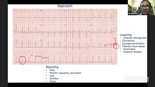 ECG 52 [upl. by Ayn]