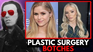 Razorfist on the Worst Plastic Surgery BOTCHES in Hollywood [upl. by Isa]