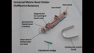 Placement of Universal Matrix Band Holder Tofflemire Retainer [upl. by Gerladina]