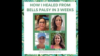 How I Healed Bells Palsy in Less Than 3 Weeks [upl. by Yanahs94]