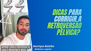 Como corrigir RETROVERSÃO PÉLVICA [upl. by Ahseekal992]