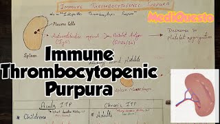 Immune Thrombocytopenic Purpura PlateletDisorders Hematology RobbinsPathology [upl. by Anelagna]