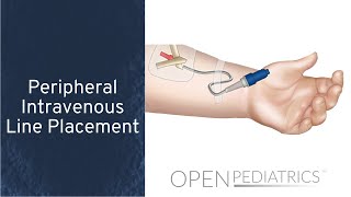 Peripheral Intravenous Line Placement by B Johnson L DelSignore  OPENPediatrics [upl. by Nobel859]