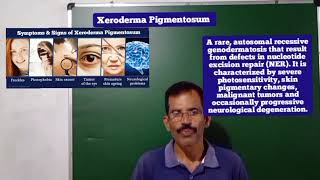 XERODERMA PIGMENTOSUM SAM BIOLOGY 🧫 CLASS [upl. by Nilerual978]