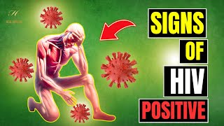 10 Signs of HIV Positive Man [upl. by Anaugal]