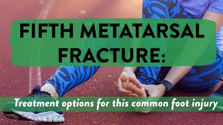 Fifth metatarsal fracture Treatment options for this common foot injury [upl. by Elyac]