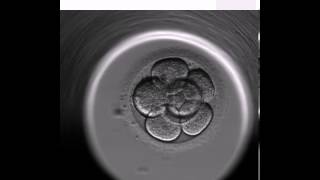 Blastocyst Video  Science at Boston IVF [upl. by Ricker]