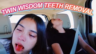 Identical Twins Get Wisdom Teeth Removed FUNNY [upl. by Eceirehs]