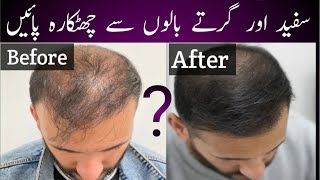 Top 10 hair growth Tips Bal girna foran band Dietitian Sadia Niaz [upl. by Thibaud]