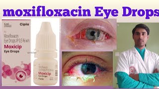 Moxifloxacin eye drop   uses side effects  dosages  composition  in hindi [upl. by Florinda692]