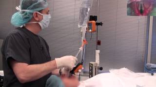 Video Laryngoscope stylet intubation [upl. by Trebuh]