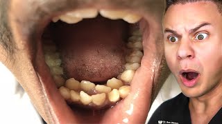 Orthodontist Reacts To The WEIRDEST Teeth On TikTok [upl. by Devine]