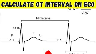 how to calculate qt interval on ecg [upl. by Laban]