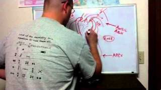 ECG Manifestations of ACS II [upl. by Canice]