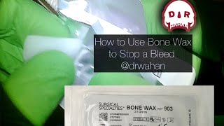 Using Bone Wax to Stop a Bleed During Dental Extraction drwahan [upl. by Amerd]