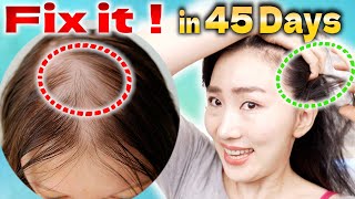 Scalp Lymphatic Drainage Massage to Improve Thinning Hair in 45 Days [upl. by Nainatrad]