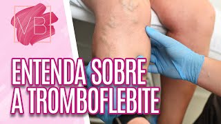 Saiba mais sobre TROMBOFLEBITE  Você Bonita 13072023 [upl. by Ettenim]