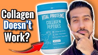 Do Collagen Supplements Work  5 HUGE Mistakes When Taking Collagen [upl. by Narayan]