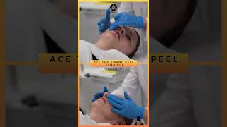 New Spicule peel  GWANG PEEL Technique by RIBESKIN acnetreatment skincare koreanskincare [upl. by Kurr860]