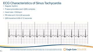 Sinus Tachycardia [upl. by Muirhead]