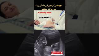 pregnancy utrasound 20 weeks baby movements 🥰🥰viral trending [upl. by Damaris]