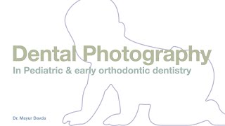 Dental Photography in Pediatric dentistry amp orthodontic cases [upl. by Ardnuassac]