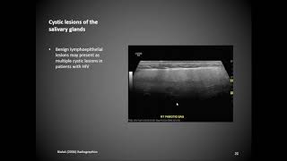 Salivary Glands [upl. by Lynad]