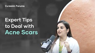 Best Ways to Treat Acne Scars Dermatologist Tips  Cureskin Podcast [upl. by Haimrej]