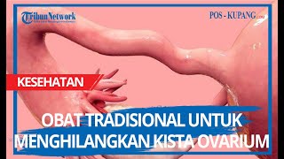 Obat Tradisional Untuk Menghilangkan Kista Ovarium [upl. by Kreg292]