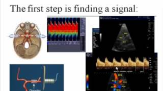 An Introduction to Transcranial Doppler [upl. by Dobson]