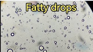 Fatty drops in Stool sample stool Stoolexamination stoolanalysis gse stooltest فحص الخروج [upl. by Olecram482]