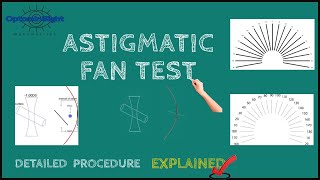 Astigmatic Fan Test Detailed Procedure and Principle Explained [upl. by Nodnar341]