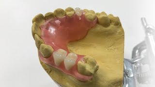 How To Make A Fiber Flex™ Partial  The Entire Process  Dental Lab Learning [upl. by Ydolem282]