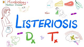 Listeria monocytogenes Listeriosis  Diagnosis and Treatment  Microbiology 🧫 [upl. by Hadihahs]