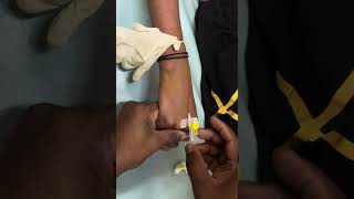 I V Cannula Fixation  I V Cannula insertion technique  I V injection shorts nurses doctor [upl. by Sankey]