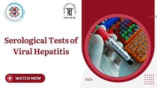 Serological Tests of Viral Hepatitis [upl. by Abbie153]